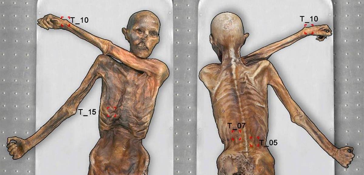 Otzi e il Mistero del Tempo