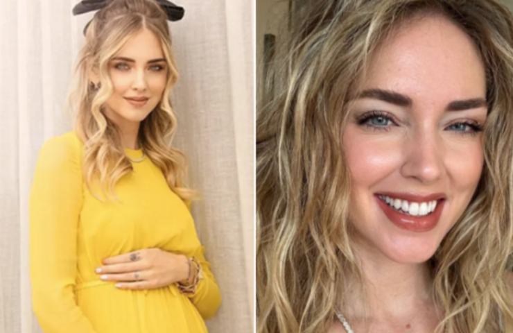 Chiara Ferragni è rifatta?